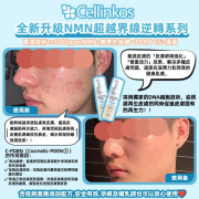 Cellinkos LED彩光EMS瘦面提拉美容儀